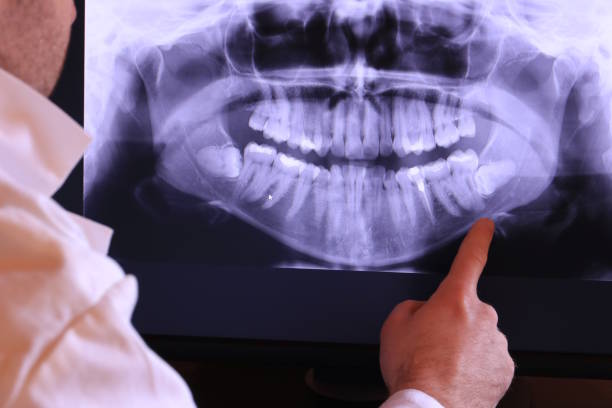 Best Dentist for Tooth Abscess  in Point Mackenzie, AK