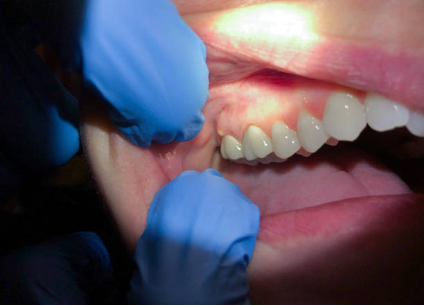 Best 24-Hour Emergency Dentist  in Point Mackenzie, AK