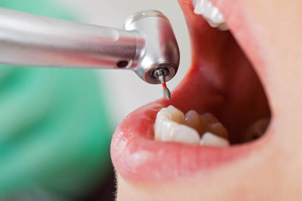 Best Dental Emergency Near Me  in Point Mackenzie, AK